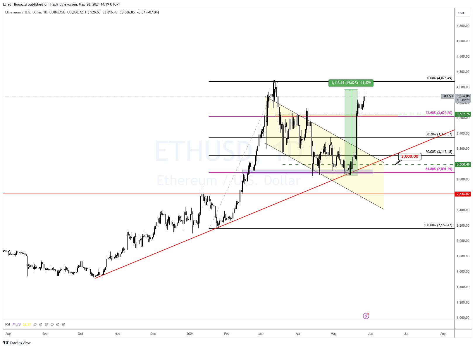 Ethereum (ETH) price technical chart.